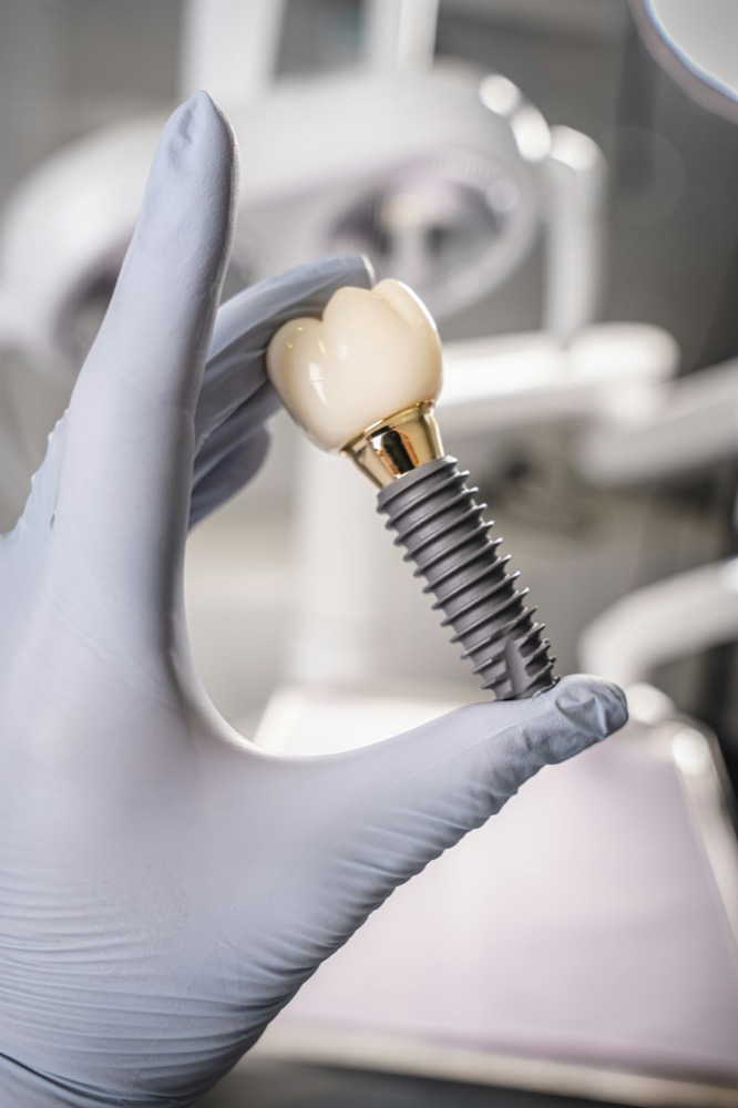 Dentist holding a dental implant and crown